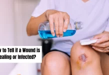 How to Tell if a Wound is Healing or Infected? How to Tell if a Wound is Healing or Infected